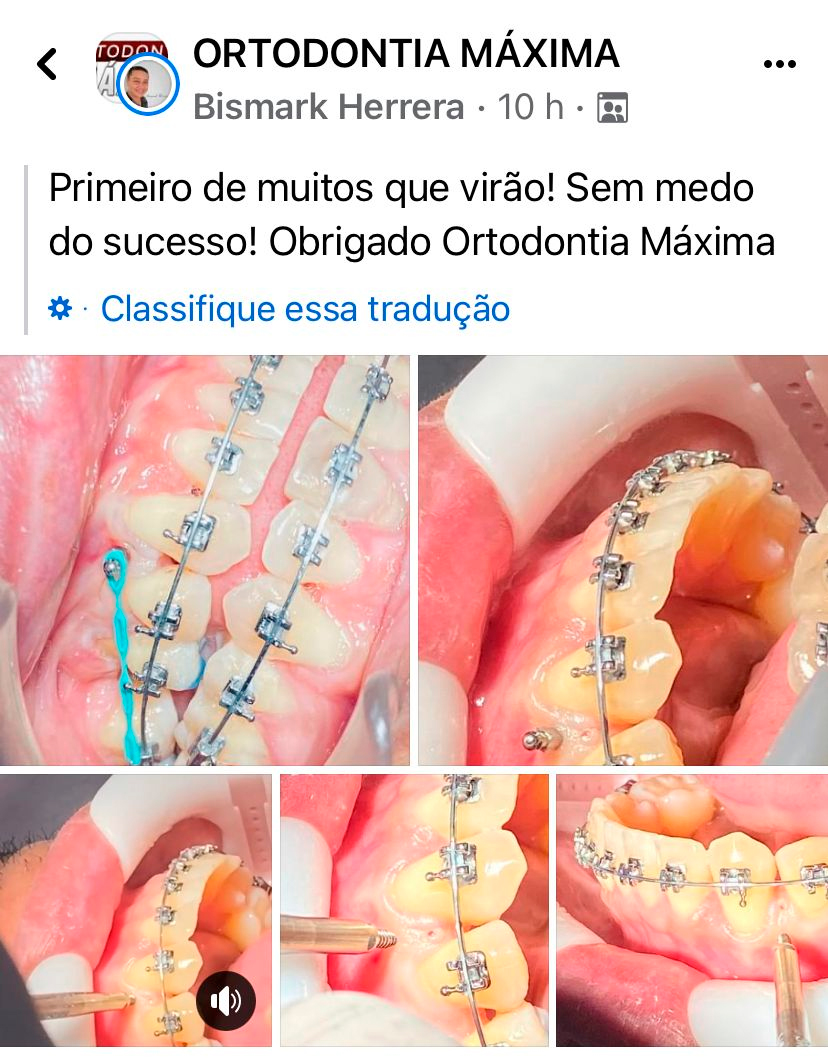 Depoimento de aluno 2 do Ortodontia Máxima