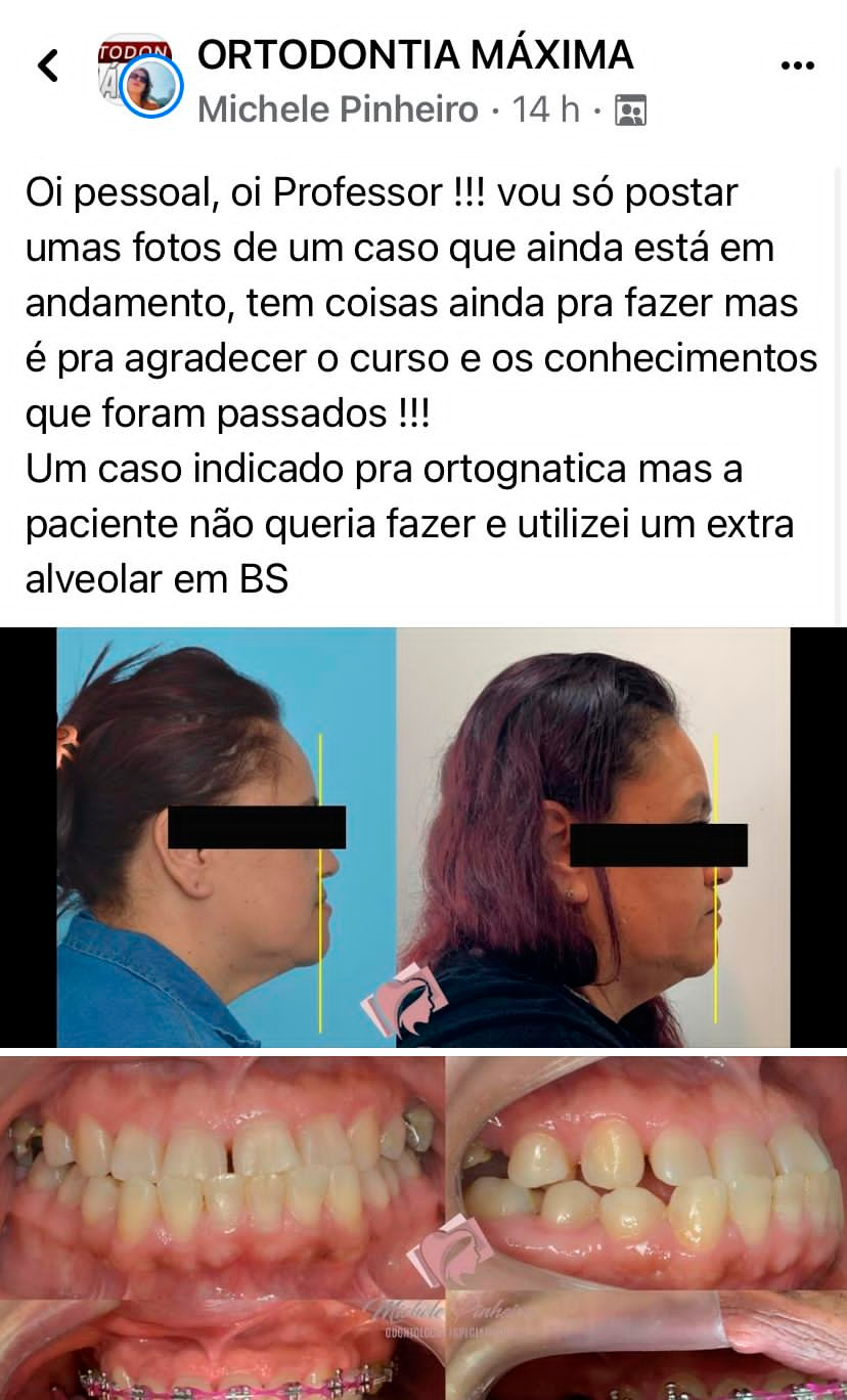 Depoimento de aluno 3 do Ortodontia Máxima